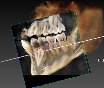 A close-up of a skull
Description automatically generated